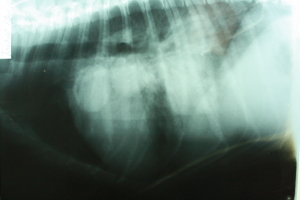 Radiografía torácica L.L con metástasis tumoral.